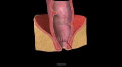 Anorectal Fistula