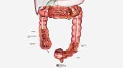 Crohn Disease