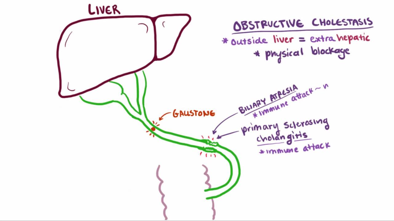 Overview of Cholestasis