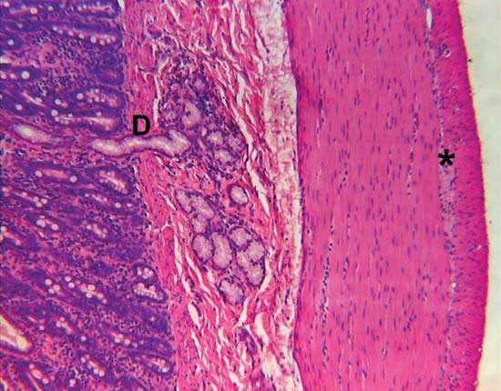 duodenum; Brunner gland