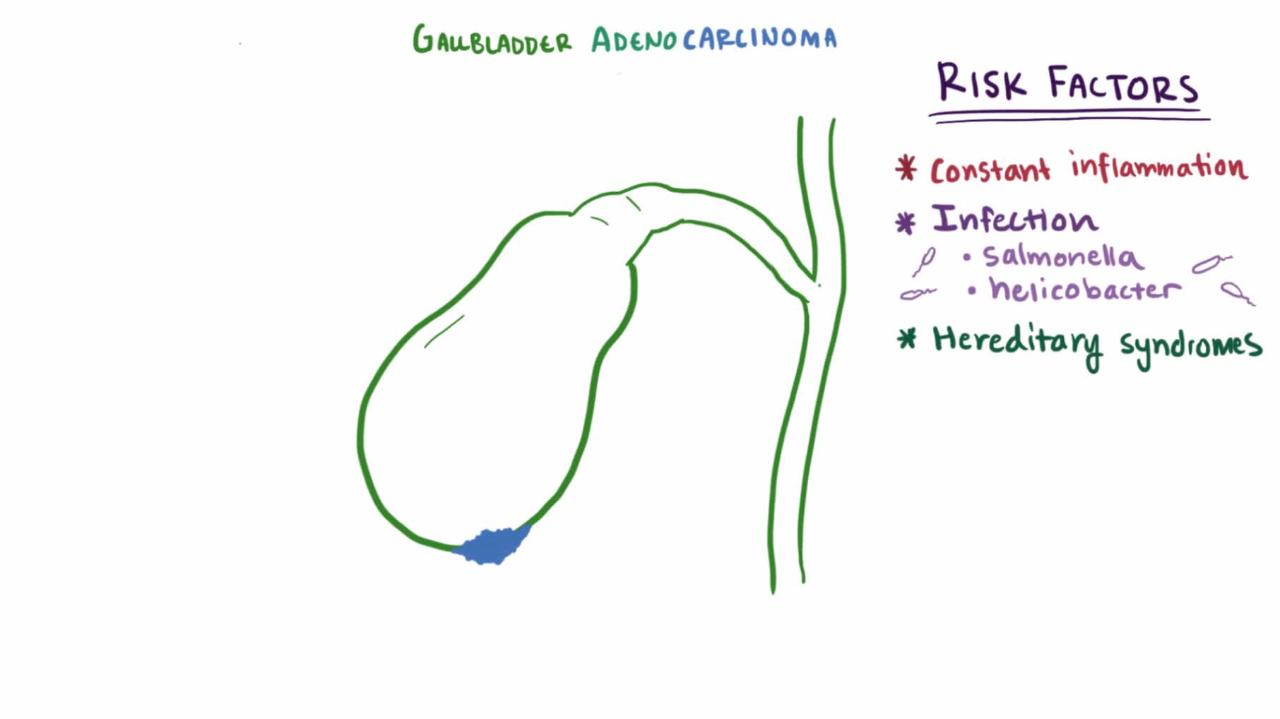 Overview of Gallbladder Cancer